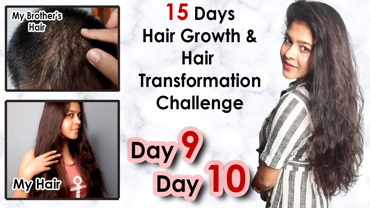 Day 9 & Day 10 : 15 Days Hair Growth Challenge With Proof | Grow Your Hair  Faster Naturally - YouTube