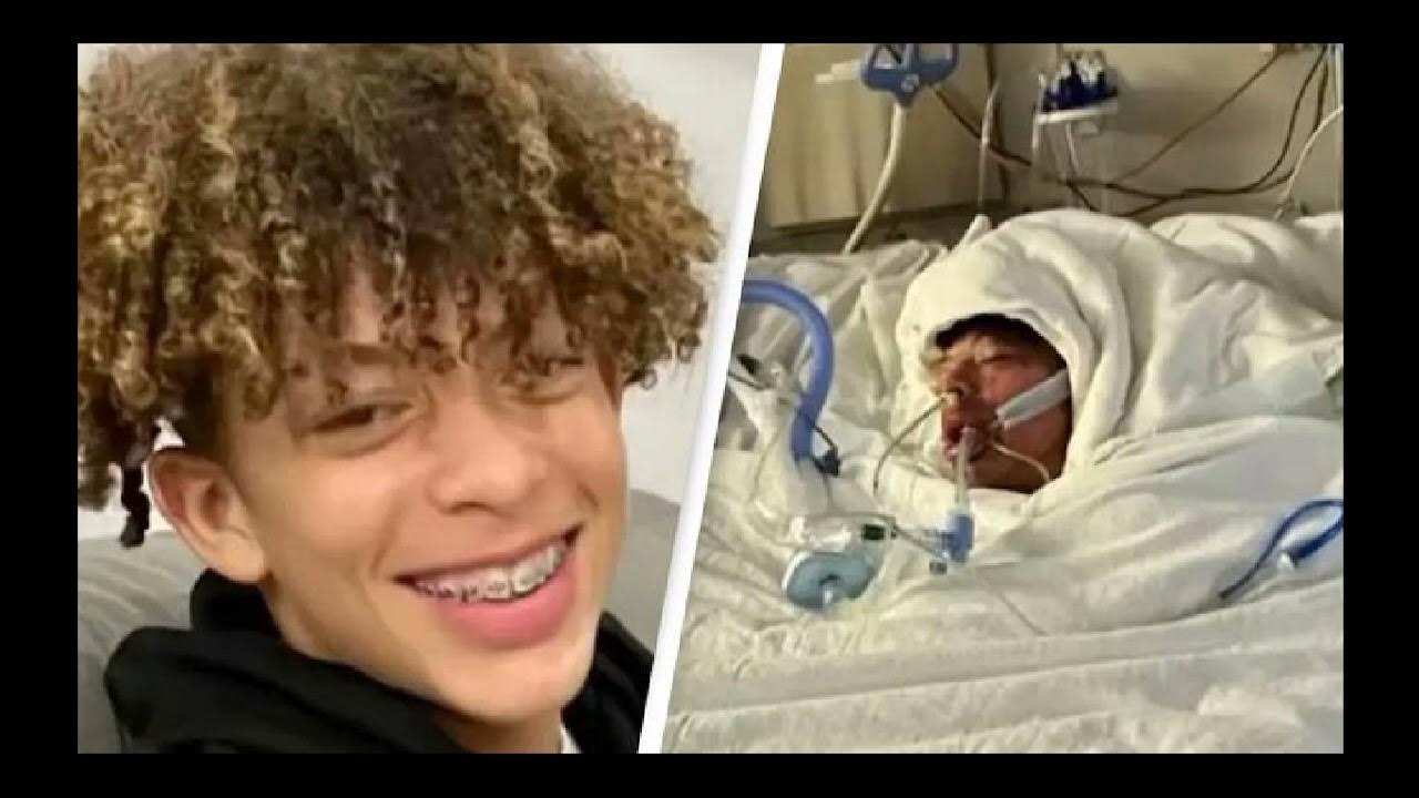 NORTH CAROLINA TEEN LEFT HORRIBLY DISFIGURED AFTER TIK TOK CHALLENGE