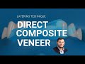 Direct Composite Veneer ( Finishing & Polishing Protocol)