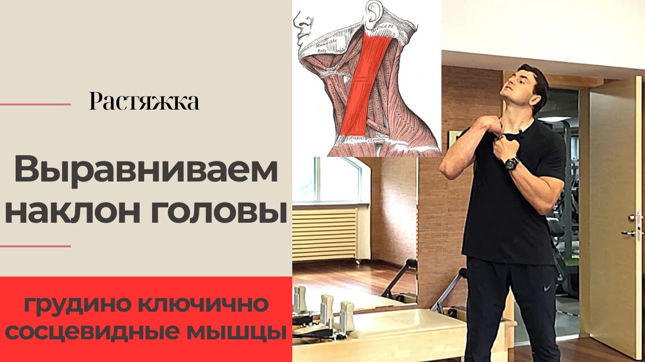 Наклон головы как исправить. Растяжка для мышц шеи. Грудино-ключично ...