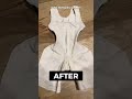 CONVERT STAGE 1 FAJA TO A STAGE 2 FAJA ЁЯШ ЁЯе ЁЯдй HOW TO тА я П Bblrecovery Faja Bbl Journey CONVERT STAGE 1 FAJA TO A STAGE 2 FAJA ЁЯШ ЁЯе ЁЯдй HOW TO тА я П Bblrecovery Faja Bbl Journey