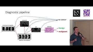 Krzysztof Geras (NYU): "Towards Solving Breast Cancer Screening Diagnosis with Deep Learning"