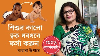 ঘরোয়া উপায়ে শিশুর কালো ত্বক ধবধবে ফর্সা করুন - শিশুর কালো ত্বক ফর্সা করার ম্যাজিক উপায় - Tan Remove