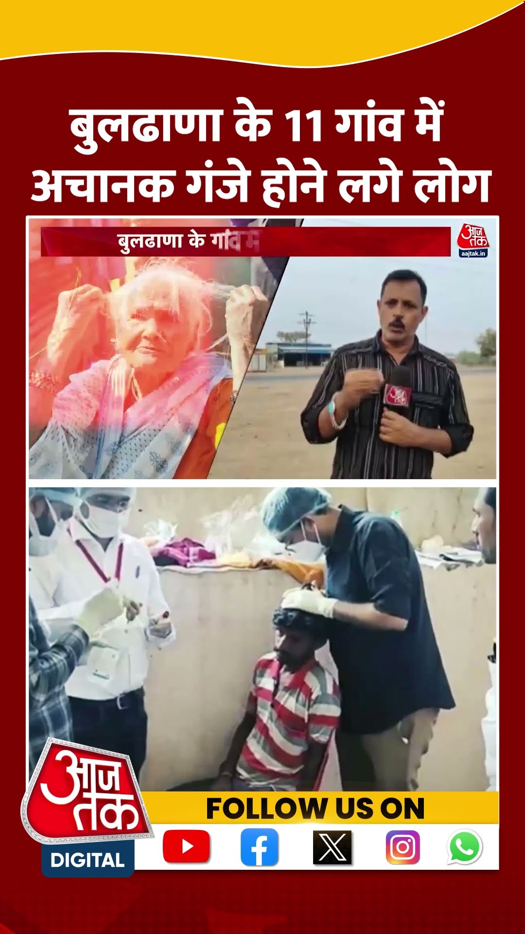 Mysterious Hair Loss In Buldhana: बुलढाणा के 11 गांव में अचानक गंजे होने लगे लोग | #shorts