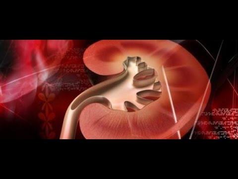 Video: Nephroptosis - Symptoms, Treatment, Exercise, Degree, Stage