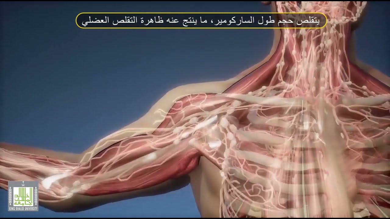 الإنقاض العضلي