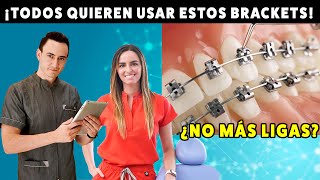 ¿Por qué ahora todos quieren brackets de autoligado? Las ventajas de NO tener ligas.