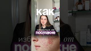 Как убрать ПОСТАКНЕ? Советы врача-косметолога 🔥 #рекомендации #skincare #косметолог #акне