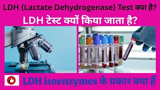 What is LDH in Hindi? / WHAT IS LDH TEST IN HINDI? / Why is the LDH test Done in? LDH  ISOENZYMES ??