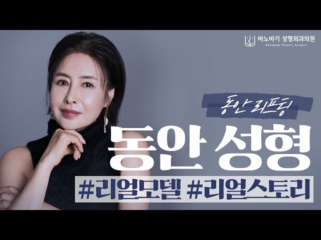 [리얼모델] 동안성형으로 10년은 더 젊어보인데요~😚