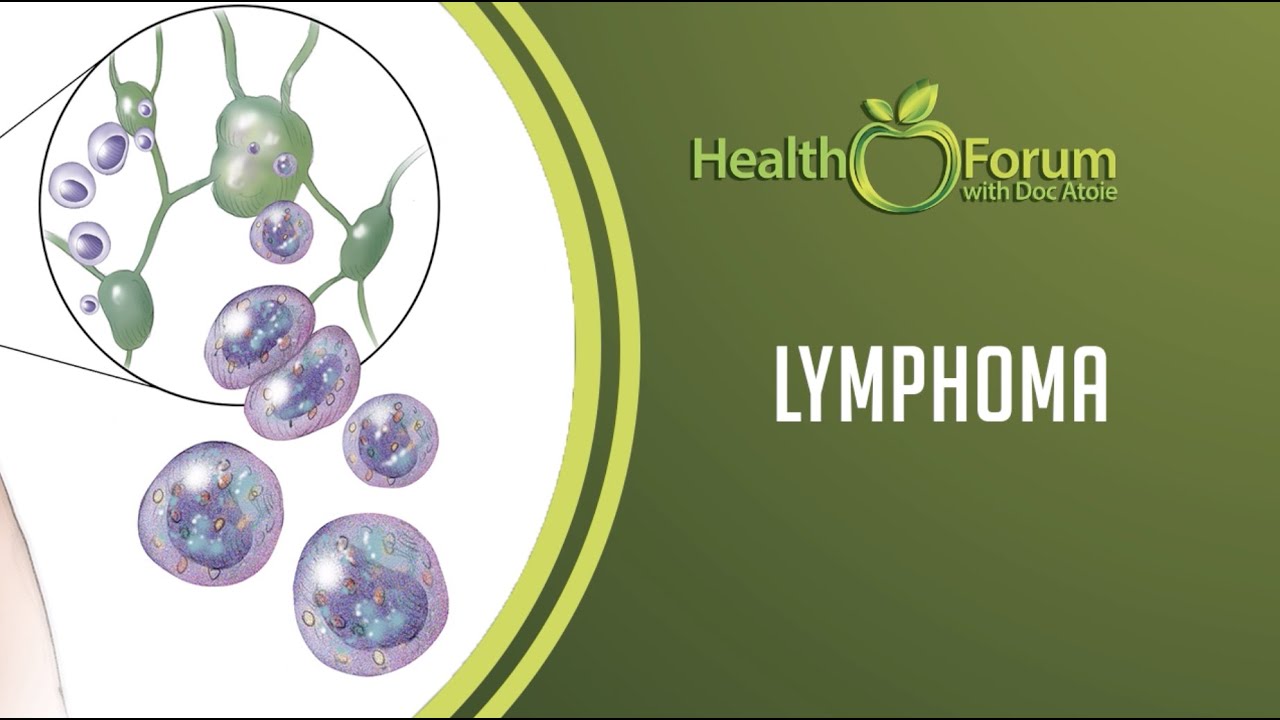 ⁣7 February 2020 | Word of the Day: Lymphoma