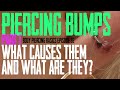 Piercing Bumps What Causes Then & What Are They Part 1 - Body Piercing Basics EP 33