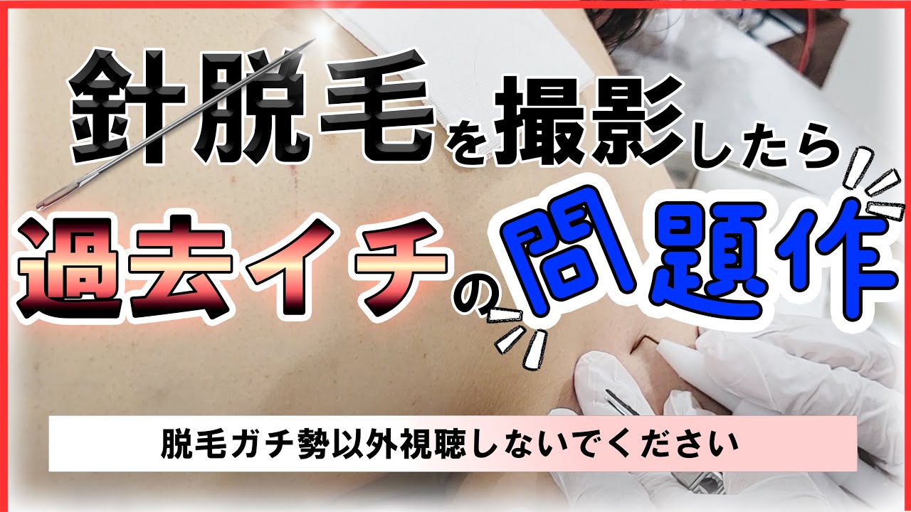 白髪・脱毛・育毛の実際 Amazon | 【2週間トライアル】ミューノアージュ Wアプローチヘア