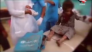فضحية مدوية : شاهد كيف يفبرك الحوثيين مقطاع الفيديو في قنواتهم