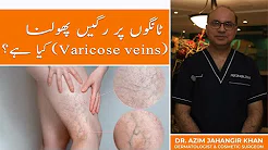 Varicose VeinsÃ¢â‚¬â„¢ Treatment in Lahore, Islamabad in Pakistan