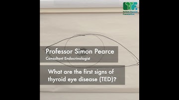 What are the first signs of thyroid eye disease (TED)? by Prof Simon Pearce #shorts #thyroid
