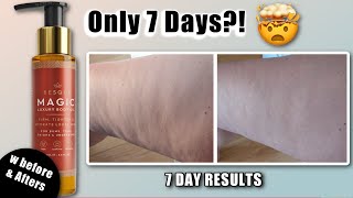 7 Days to Smoother Thighs ✨ Besque Magic Oil Cellulite & Firming Results! 🤯