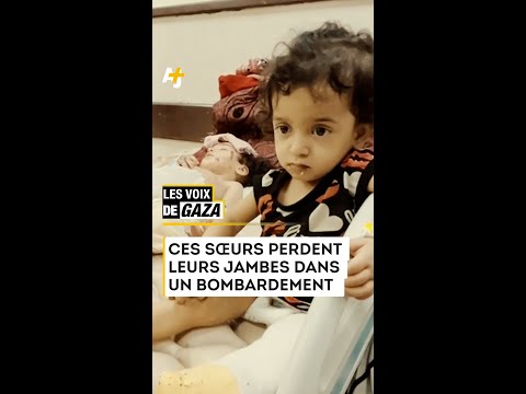 هذه الأخوات الثلاثة التي فقدت قدمها في قنبلة إسرائيلية: