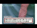 福島ドクターズＴＶ「下肢静脈瘤（かしじょうみゃくりゅう）」