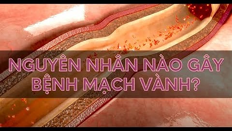 NGUYÊN NHÂN GÂY BỆNH MẠCH VÀNH  | Alo bác sĩ Chuyên trang Tạp chí Sức khoẻ Cộng đồng