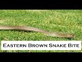 Aggressive eastern brown snake  multiple attempts to bite snake catcher