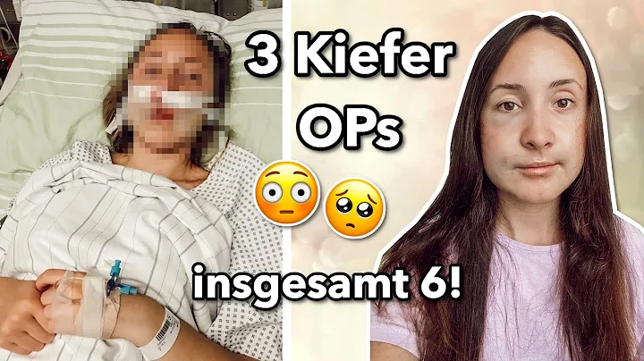Deshalb hatte ich 3 Kiefer OPs! Insgesamt 6 Operat...
