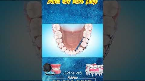 [3D] NIỀNG RĂNG MẮC CÀI || Nha Khoa Quốc Tế Athena