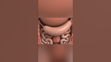 Appendicitis: How the Appendix Gets Inflamed