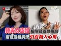 韓美女空姐摔倒頭蓋骨被削  復健最新病況引百萬人心疼｜三立新聞網 SETN.com