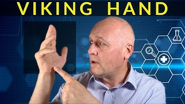 Dupuytren’s Contracture : All about the ‘Viking Hand’