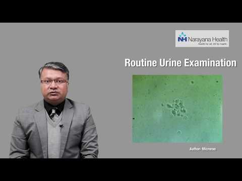 Video: 6 manieren om schuimende urine te verminderen