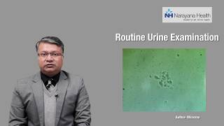 Diagnosis & Treatment of Foamy Urine | Dr. Vikas Jain