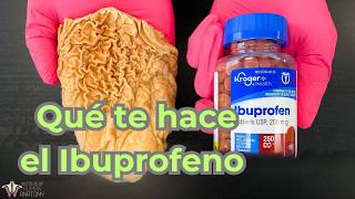 Lo que NO sabes del Ibuprofeno