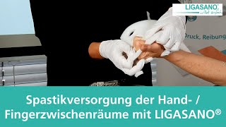 Spastikversorgung Der Hand Und Fingerzwischenraume Mit Ligasano Youtube