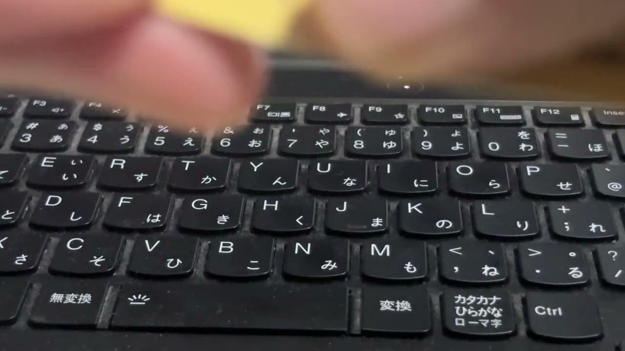 片頭痛が酷くて脳神経外科に行きました