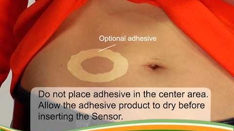 Dexcom G4 PLATINUM (Pediatric): Inserting Your Sensor