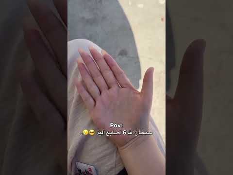 البنت عندها 6 اصابع Shortvideo 