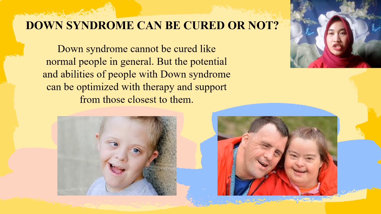 Синдром дауна эко. Синдром дауна семиотика. Синдром дауна эко. Синдром дауна эко. Chromosomes disease.