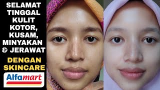 SKINCARE UNTUK KULIT BERMINYAK,KUSAM & BERJERAWAT DI ALFAMART!