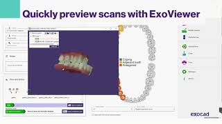MyiTero for labs integration with exocad DentalCAD 3.0 Galway screenshot 1
