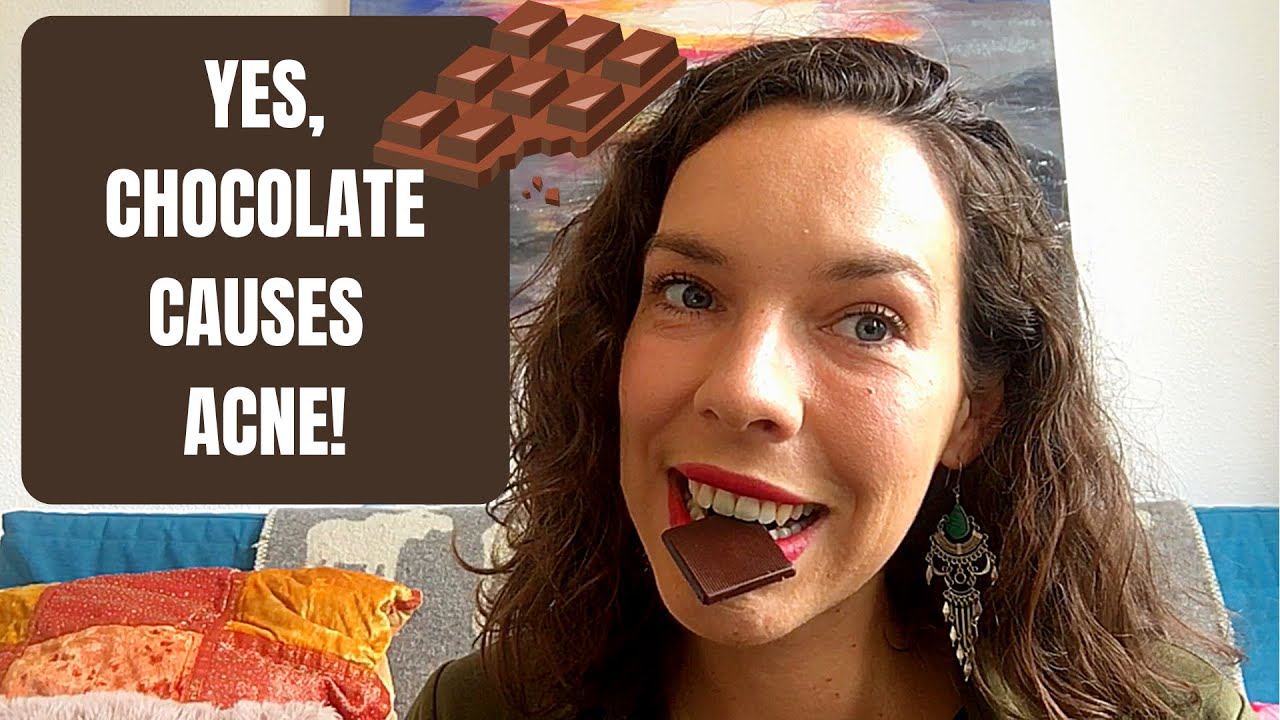 Does CHOCOLATE Cause Acne? (Yes, It Does!) - Chocolate Acne Relationship