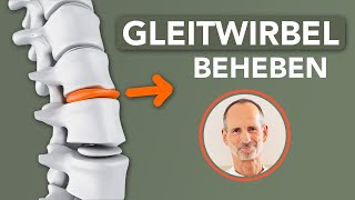 Was du bei Gleitwirbel tun kannst, um dir selbst zu helfen (gegen Rückenschmerzen)