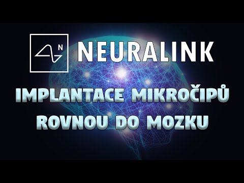 Video: V Napoleonově Hlavě Byl Nalezen Cizí Mikročip - Alternativní Pohled