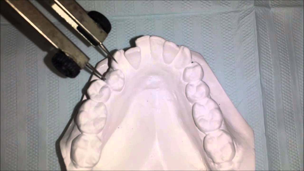 Discrepância de modelo simplificada
