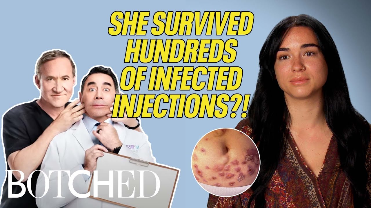 У Беатрис сотни шрамов и медицинские счета на 1 миллион долларов?! (До и после) | Неудачная опера...