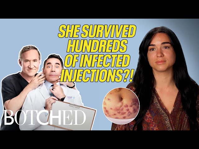 A Fake Med Spa Gave Beatriz HUNDREDS of Contaminated Injections?! (Before &  After) | Botched | E! - YouTube