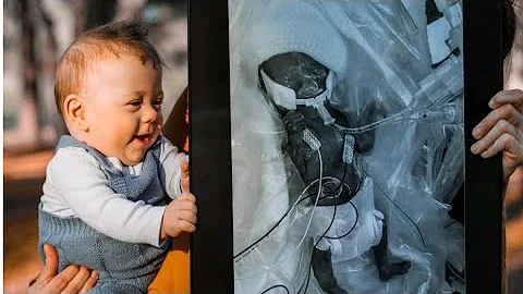 Against all odds, Georgia toddler born at 22 weeks continues to thrive