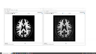 Coordinate system in NIFTI and how to convert them