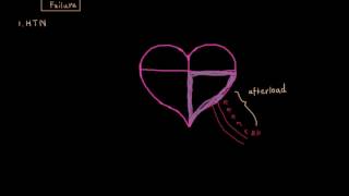 Congestive Heart Failure - Pathophysiology (1)