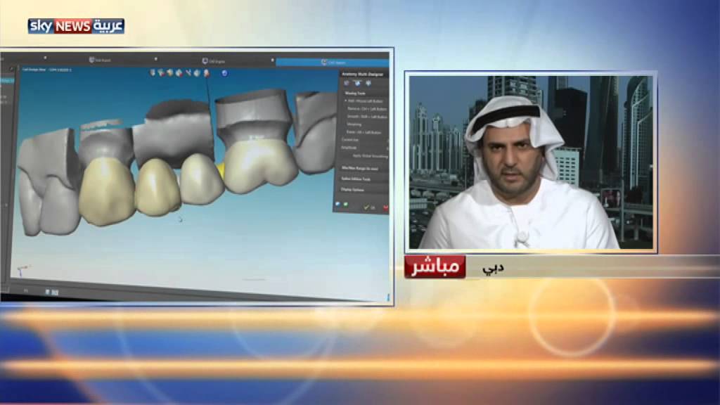 دبي.. أحدث الابتكارات بمجال طب الأسنان
